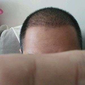发际线分享社区