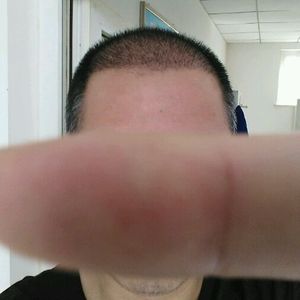 发际线分享社区