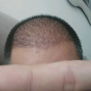 发际线分享社区