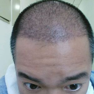 发际线分享社区