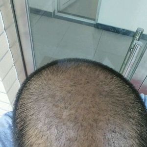 发际线分享社区