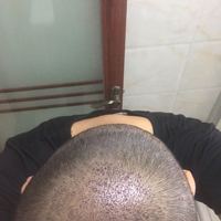 發(fā)際線用戶圖片