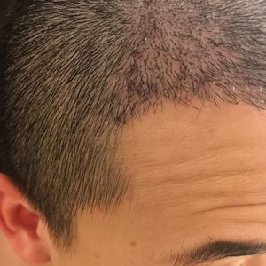 发际线分享社区