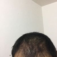 發(fā)際線用戶圖片