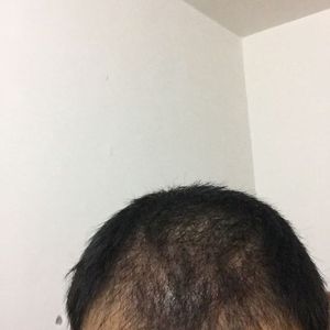 发际线分享社区