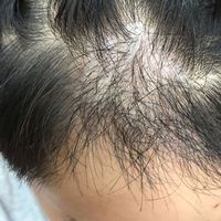 發(fā)際線用戶圖片