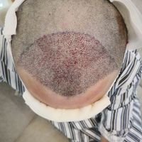 發(fā)際線用戶圖片