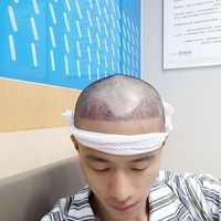發(fā)際線用戶圖片