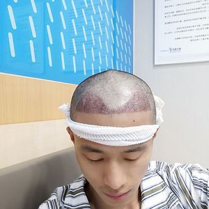 发际线分享社区