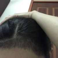 發(fā)際線用戶圖片