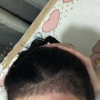發(fā)際線用戶圖片