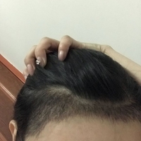 發(fā)際線用戶圖片