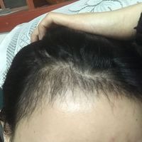 發(fā)際線用戶圖片