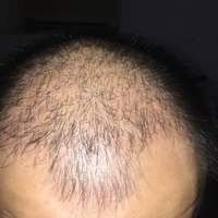 發(fā)際線用戶圖片