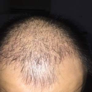 发际线分享社区
