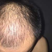 發(fā)際線用戶圖片