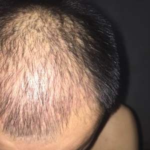 发际线分享社区