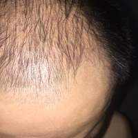 發(fā)際線用戶圖片