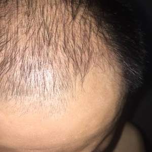 发际线分享社区