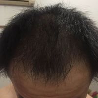 發(fā)際線用戶圖片