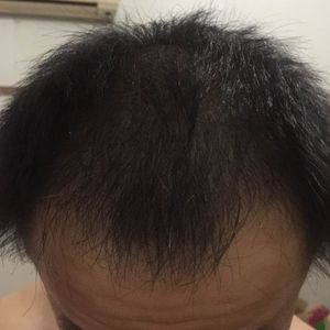 发际线分享社区