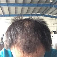 發(fā)際線用戶圖片
