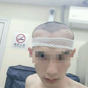 发际线分享社区