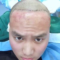 發(fā)際線用戶圖片
