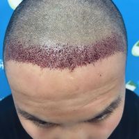 發(fā)際線用戶圖片