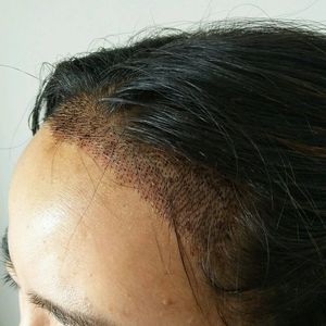 发际线分享社区