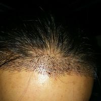 發(fā)際線用戶圖片