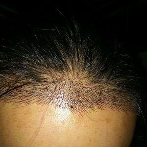 发际线分享社区