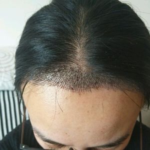 发际线分享社区