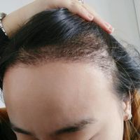 發(fā)際線用戶圖片