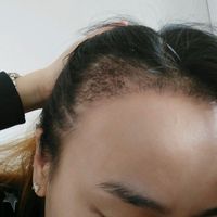 發(fā)際線用戶圖片