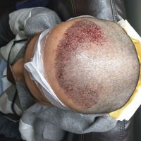 發(fā)際線用戶圖片