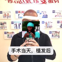 發(fā)際線用戶圖片