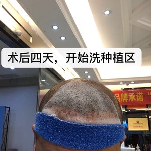 发际线分享社区