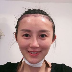 发际线分享社区
