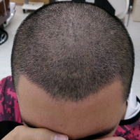 發(fā)際線(xiàn)用戶(hù)圖片
