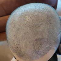 發(fā)際線(xiàn)用戶(hù)圖片