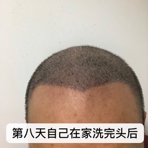 发际线分享社区