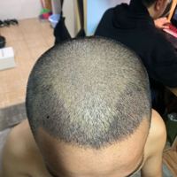 發(fā)際線(xiàn)用戶(hù)圖片