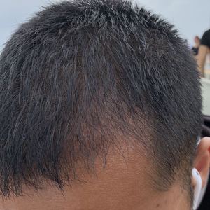 发际线分享社区