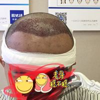 發(fā)際線用戶圖片