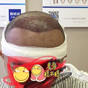 发际线分享社区