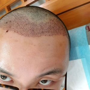发际线分享社区