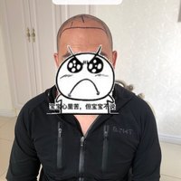 發(fā)際線用戶圖片