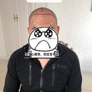 发际线分享社区