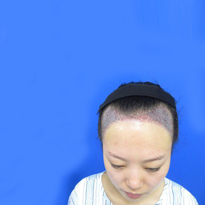 发际线分享社区